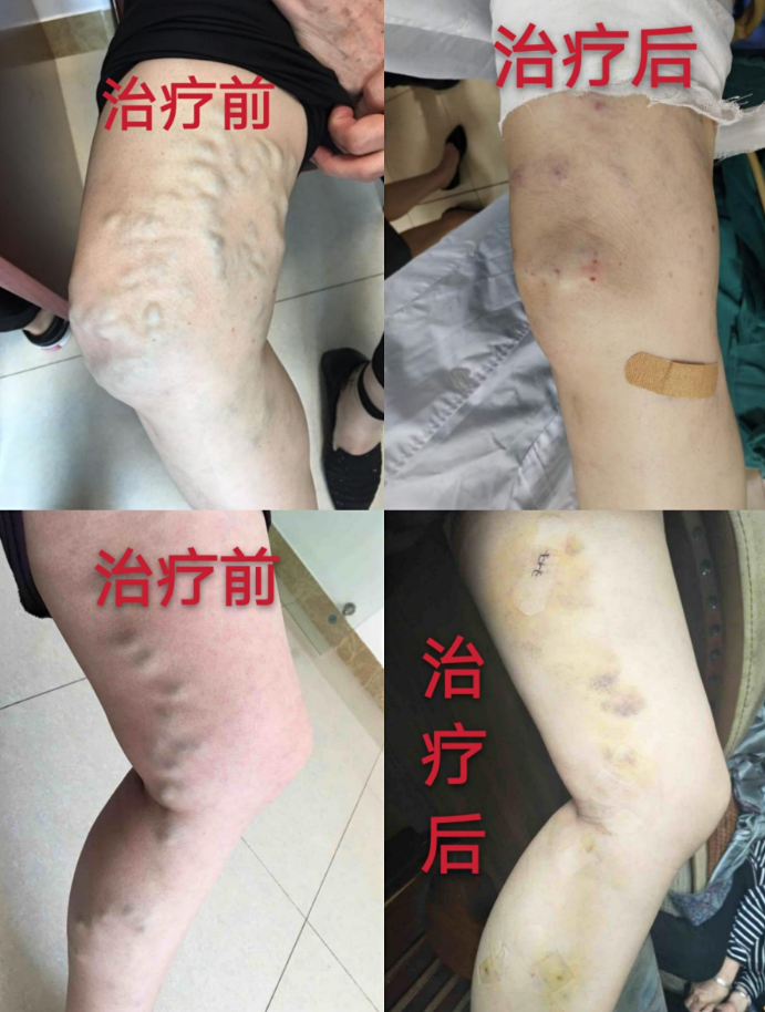 QQ截图20201111160129.png