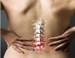 科普 | 腰椎间盘突出和腰椎间盘突出症是一回事吗？